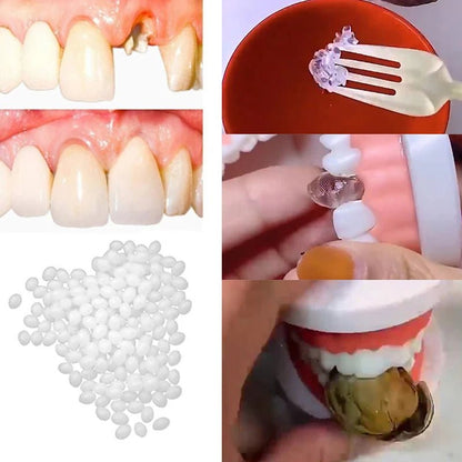 10g - 30g Temporary Tooth Repair Kit Teeth And Gaps FalseTeeth Solid Glue Denture Adhesive Teeth Whitening Tooth Beauty Tool - by PAWFECTWORLDS | PAWFECTWORLDS | , ,