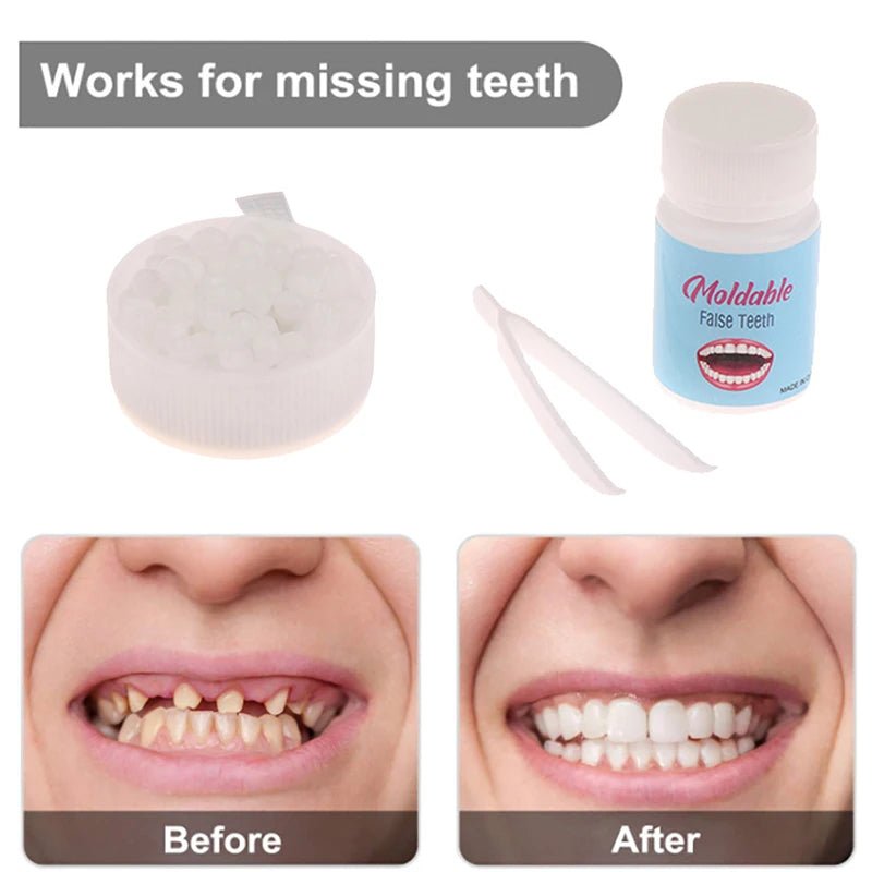 10g - 30g Temporary Tooth Repair Kit Teeth And Gaps FalseTeeth Solid Glue Denture Adhesive Teeth Whitening Tooth Beauty Tool - by PAWFECTWORLDS | PAWFECTWORLDS | , ,