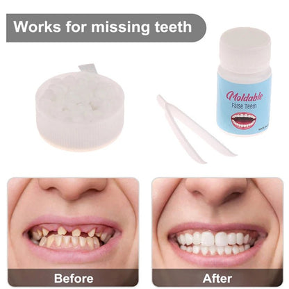 10g - 30g Temporary Tooth Repair Kit Teeth And Gaps FalseTeeth Solid Glue Denture Adhesive Teeth Whitening Tooth Beauty Tool - by PAWFECTWORLDS | PAWFECTWORLDS | , ,